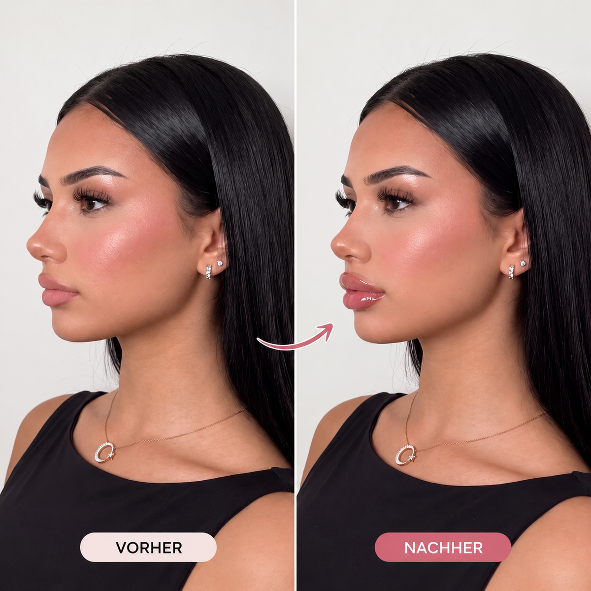 Bellaré Lip Plumper Set 4-in-1