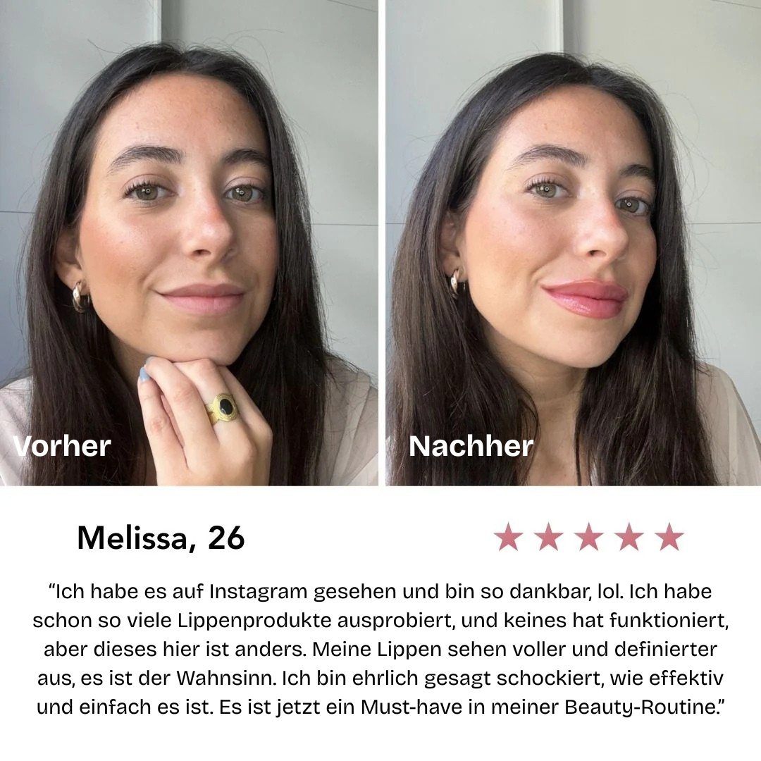 Bellaré - Lip Plumper