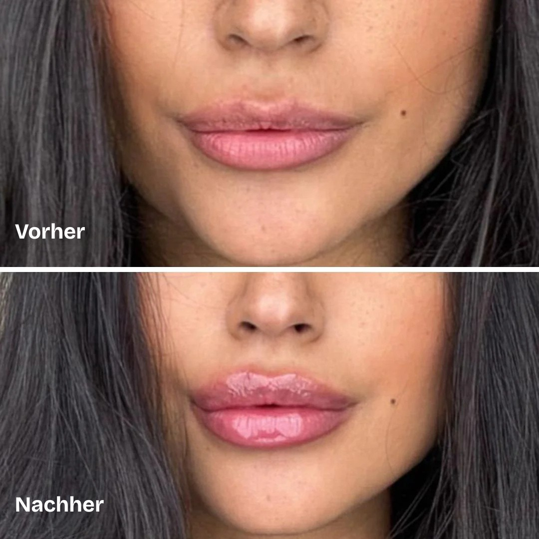 Bellaré -  Lip Plumper